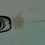 Descubren que el esperma congelado tiene los mismos resultados que el semen fresco