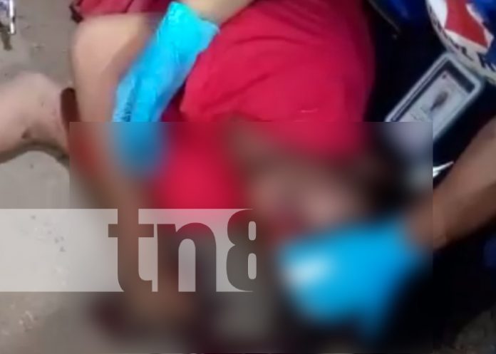 Foto: Encontronazo deja a motociclistas luchando por sus vidas, en Xiloa / TN8