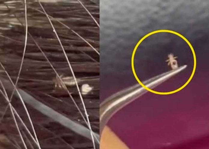 1 Estilista se da tremendo susto al recibir una cliente “piojosa”