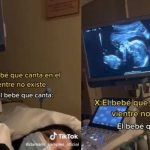 Bebé se vuelve viral por salir “cantando” en el ultrasonido Bebé se vuelve viral por salir “cantando” en el ultrasonido