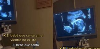 Bebé se vuelve viral por salir “cantando” en el ultrasonido