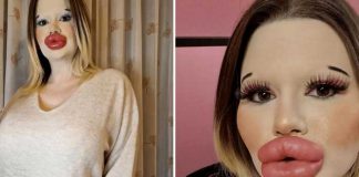 Fotos: Mujer con enormes labios planea batir “otro récord” corporal