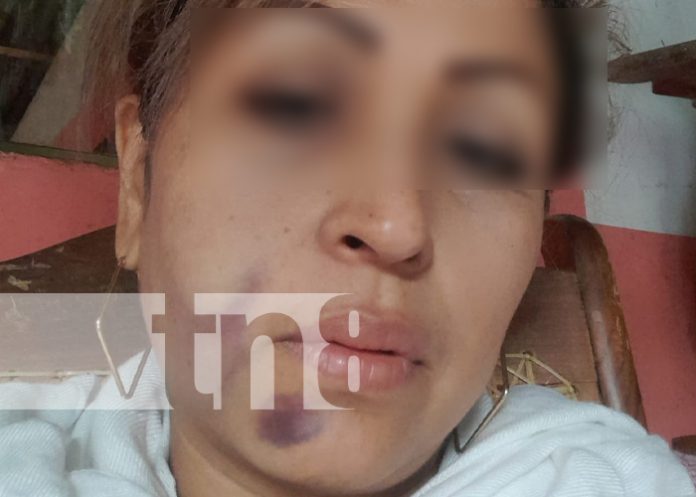 Delincuentes golpean salvajemente a una mujer en la Isla de Ometepe