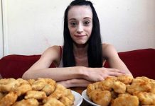 ¡Insólito! Mujer asegura que el único alimento que puede comer es el pollo ¡Insólito! Mujer asegura que el único alimento que puede comer es el pollo