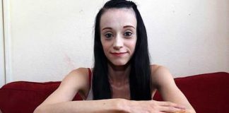¡Insólito! Mujer asegura que el único alimento que puede comer es el pollo