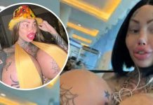 ¡De locos! Mujer le explota un seno y muestra el resultado (VIDEO) ¡De locos! Mujer le explota un seno y muestra el resultado (VIDEO)