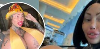 ¡De locos! Mujer le explota un seno y muestra el resultado (VIDEO)