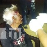 Juigalpa: Ancianito herido tras ser atropellado por un motociclista en El Ayote Foto: Ancianito herido tras ser atropellado por un motociclista en El Ayote, en Juigalpa / TN8