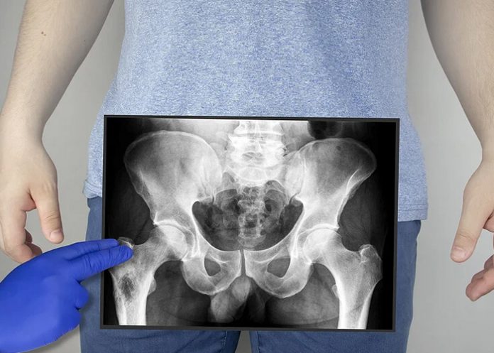 Chavalo se introduce objeto extraño por el 