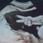 Padres atónitos al recibir señal de amor y paz en ultrasonido de su bebé Bebé sorprende a sus papás con la señal de amor y paz en ultrasonido