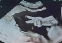 Padres atónitos al recibir señal de amor y paz en ultrasonido de su bebé Bebé sorprende a sus papás con la señal de amor y paz en ultrasonido