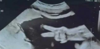 Bebé sorprende a sus papás con la señal de amor y paz en ultrasonido