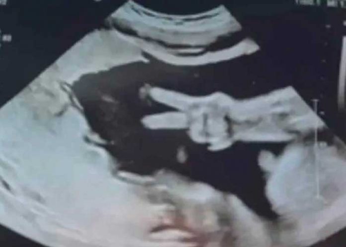 BEBE Bebé sorprende a sus papás con la señal de amor y paz en ultrasonido