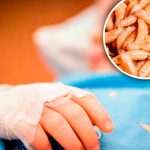 ¡Tremendo descuido! Le extraen 100 gusanos de la cabeza a menor en Paraguay ¡Tremendo descuido! Le extraen 100 gusanos de la cabeza a menor en Paraguay