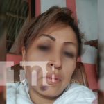 ¡Horrendo! Sobrina señala a tío, de intentar matarla en la Isla de Ometepe ¡Horrendo! Sobrina señala a tío, de intentar matarla en la Isla de Ometepe