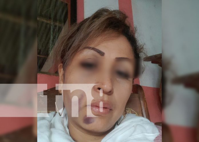 ¡Horrendo! Sobrina señala a tío, de intentar matarla en la Isla de Ometepe