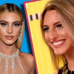 El antes y después de sus cirugías de Lele Pons ahora esposa de Guaynaa