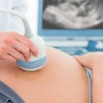 ¿Cómo debes prepararte para el parto? ¿Cómo debes prepararte para el parto?