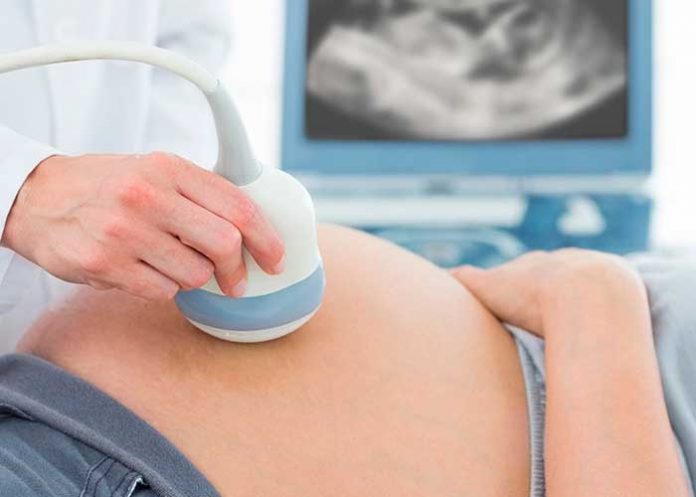 1 ¿Cómo debes prepararte para el parto?