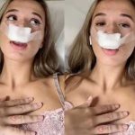 ¡De locos! Se realizó una rinoplastia para que sus bebés tuvieran “nariz perfecta”