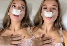 ¡De locos! Se realizó una rinoplastia para que sus bebés tuvieran “nariz perfecta” ¡De locos! Se realizó una rinoplastia para que sus bebés tuvieran “nariz perfecta”