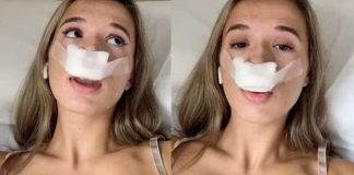¡De locos! Se realizó una rinoplastia para que sus bebés tuvieran “nariz perfecta”