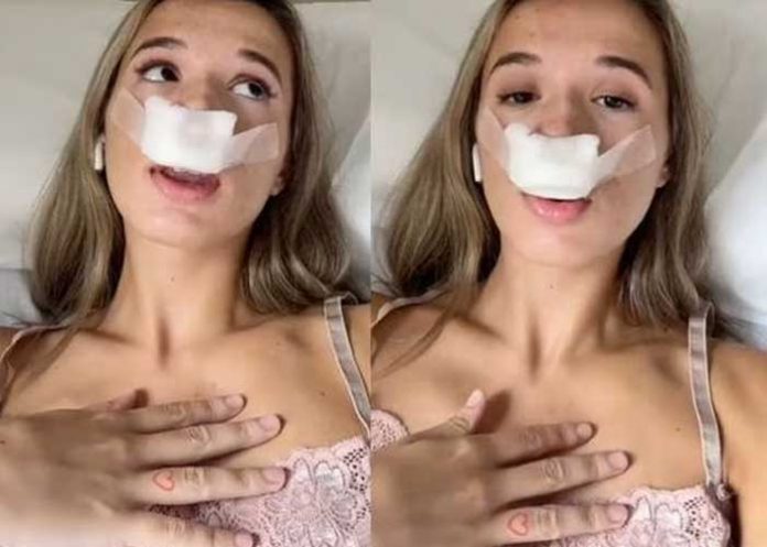 ¡De locos! Se realizó una rinoplastia para que sus bebés tuvieran “nariz perfecta”