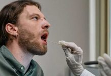 Ojo : El exceso de saliva podría ser una mala señal Ojo : El exceso de saliva podría ser una mala señal