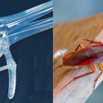 ¡De película! Ginecólogo encuentra cucaracha en la parte íntima de una mujer Cucaracha en la parte íntima de una mujer