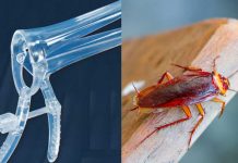 ¡De película! Ginecólogo encuentra cucaracha en la parte íntima de una mujer Cucaracha en la parte íntima de una mujer