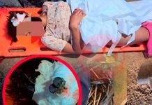¡Abominable! En Perú violan a niña y le incrustan clavos en su cabeza ¡Abominable! Violan a niña y le incrustan clavos en la cabeza en Perú
