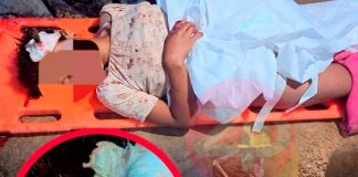 ¡Abominable! Violan a niña y le incrustan clavos en la cabeza en Perú