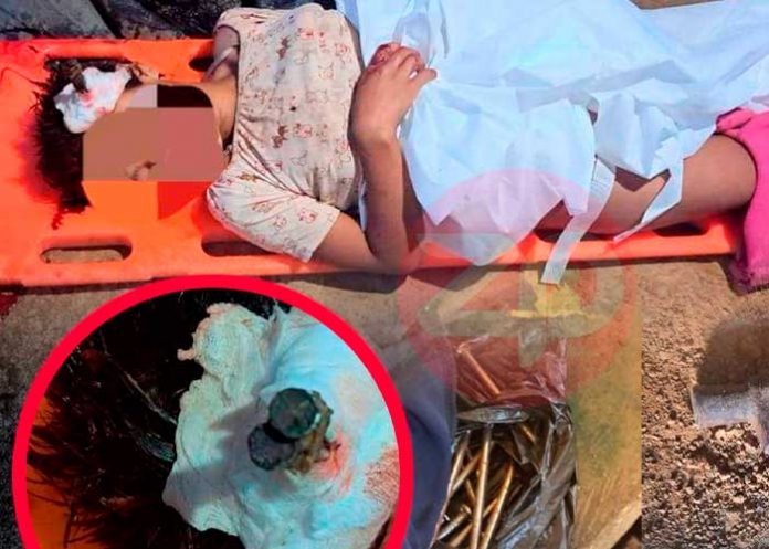 peru2 ¡Abominable! Violan a niña y le incrustan clavos en la cabeza en Perú