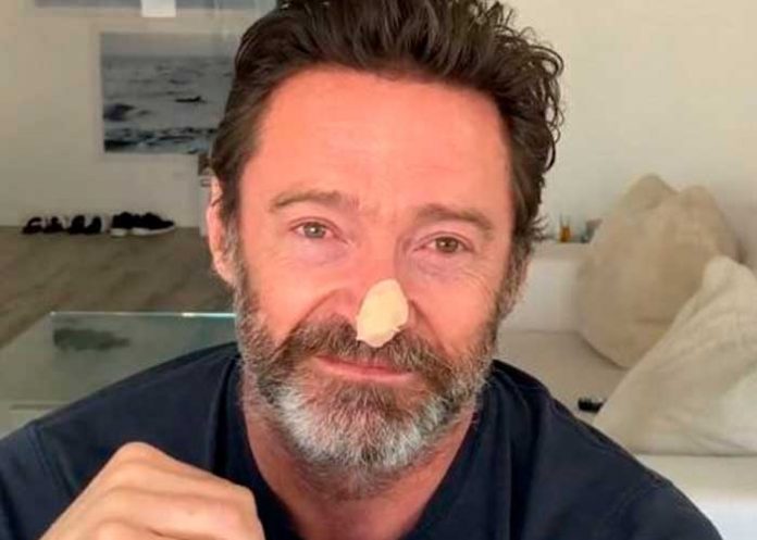 1 El actor Hugh Jackman se somete a biopsias para descartar cáncer de piel