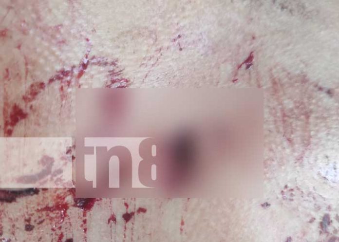 Sin piedad, hombre acribilla a su víctima de una estocada con arma blanca en Wiwilí