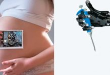Nacen las primeras bebés concebidas por un robot en Estados Unidos