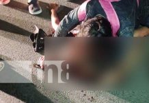 Foto: La “Zorrita” Resultó gravemente lesionado al ser arrollado por un vehículo en Juigalpa, Chontales / TN8