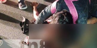 Foto: La “Zorrita” Resultó gravemente lesionado al ser arrollado por un vehículo en Juigalpa, Chontales / TN8