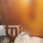 ¡Se salvó! Hombre es víctima de una puñalada en Rivas Foto: ¡Se salvó! Hombre es víctima de una puñalada en Rivas / TN8