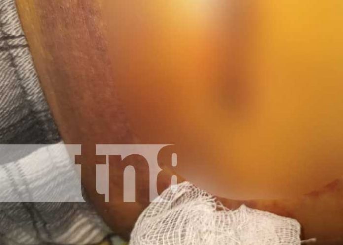 Foto: ¡Se salvó! Hombre es víctima de una puñalada en Rivas / TN8