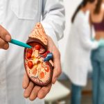 ¿Sientes dolor y no sabes que es? ¡Cuidado son los Cálculos renales!