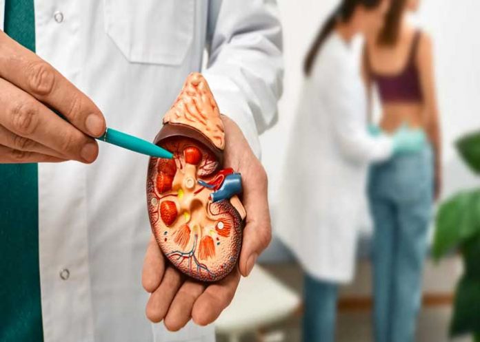 3 ¿Sientes dolor y no sabes que es? ¡Cuidado son los Cálculos renales!