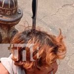 Foto: Agresión con cuchillo a un hombre en Managua / TN8