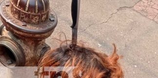 Foto: Agresión con cuchillo a un hombre en Managua / TN8