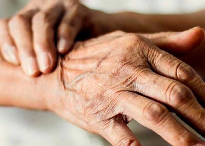 est El párkinson es una de las principales patologías del cerebro