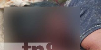 Foto: ¡Hombre descarga su furia! Agrediendo salvajemente a su cónyuge en Nueva Segovia / TN8
