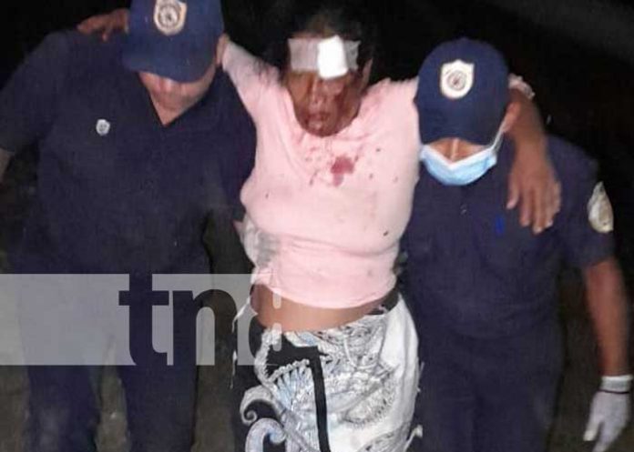 1 ¡Vivos de milagro!, se van a vacío tras perder el control de su moto en El Ayote