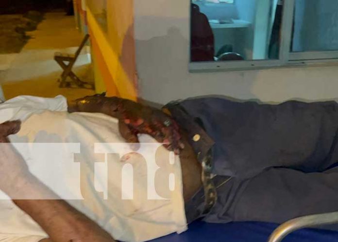 Anciano sufre quemaduras tras caer en un incendio de malezas en Chontales