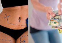 ¡Descarada! Pide dinero para tratar ‘supuesto cáncer’, pero se hizo una liposucción mujer pidió dinero para tratamiento de supuesto ‘cáncer