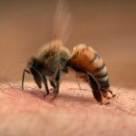 Una muerte espantosa: Esto dice la ciencia del ataque masivo de abejas Foto: Picaduras de abejas